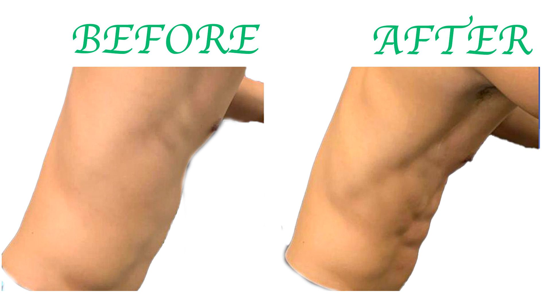 six packs made by endopeel