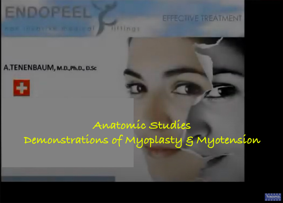 endopeel-cadavers-masseter