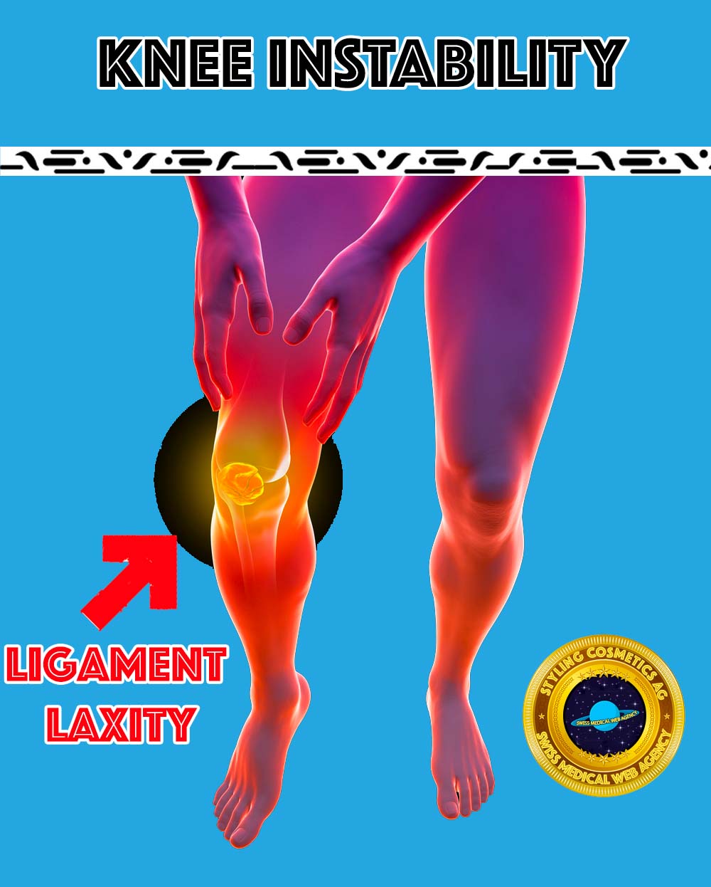 Knieinstabilit&auml;t