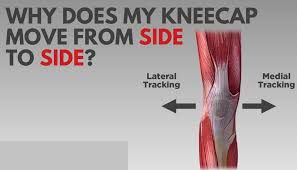 knee instability 