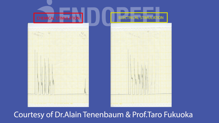 chemical & electrical stimulation of the muscle