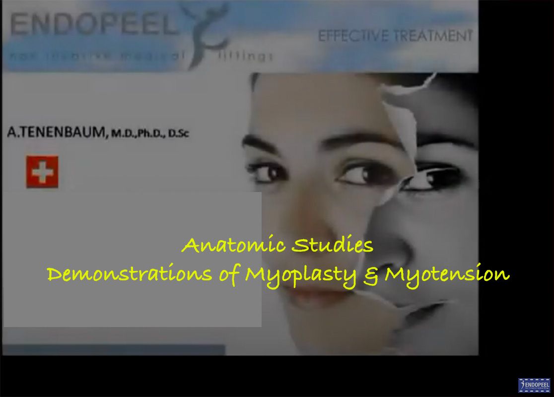 endopeel-cadavers-masseter