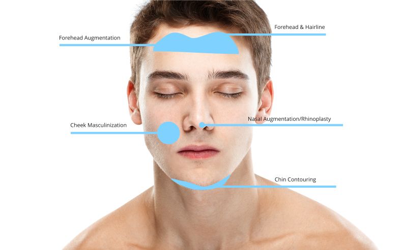 masculinization 
